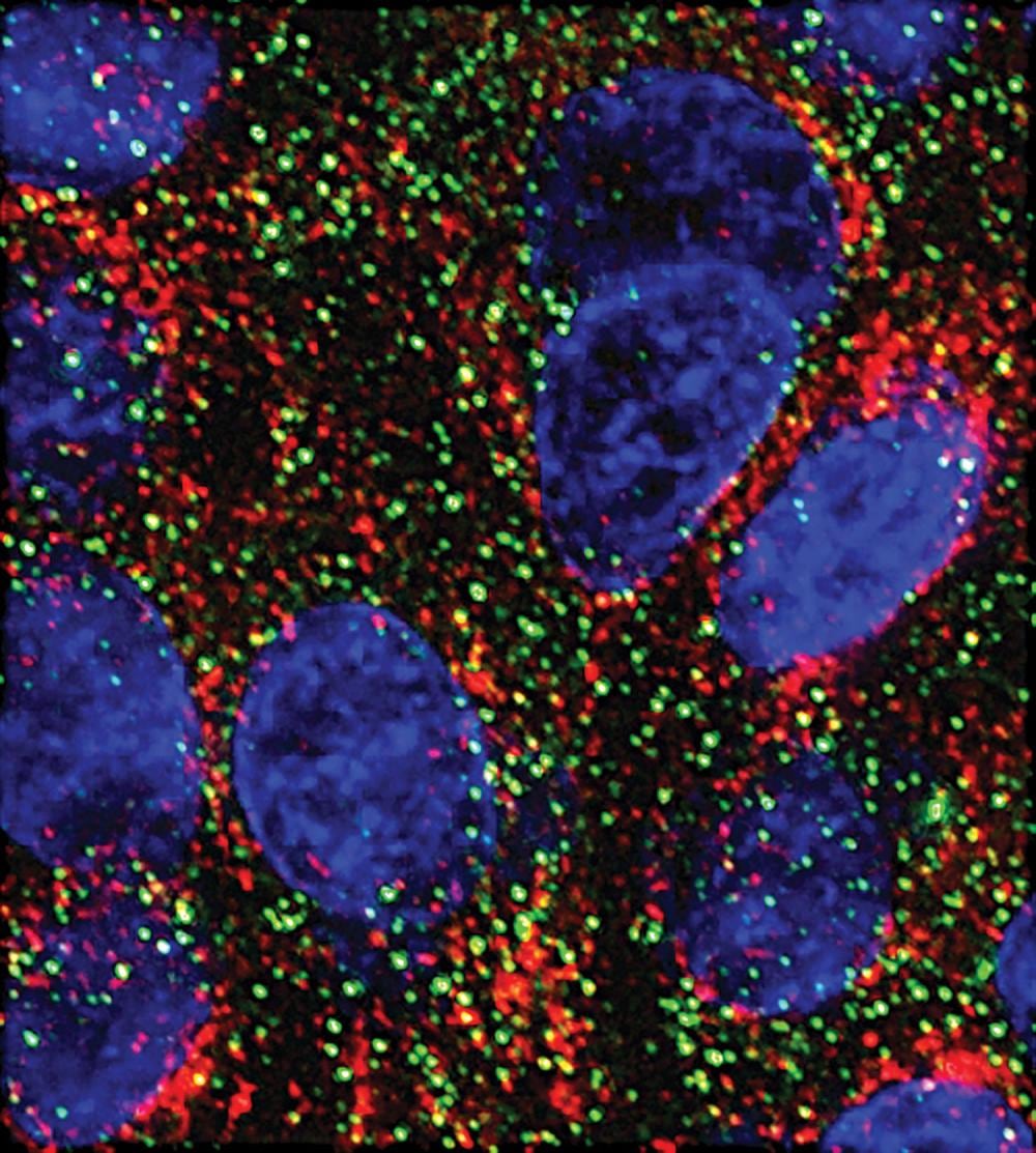 Dos microARN frenan el crecimiento del cáncer de páncreas en laboratorio